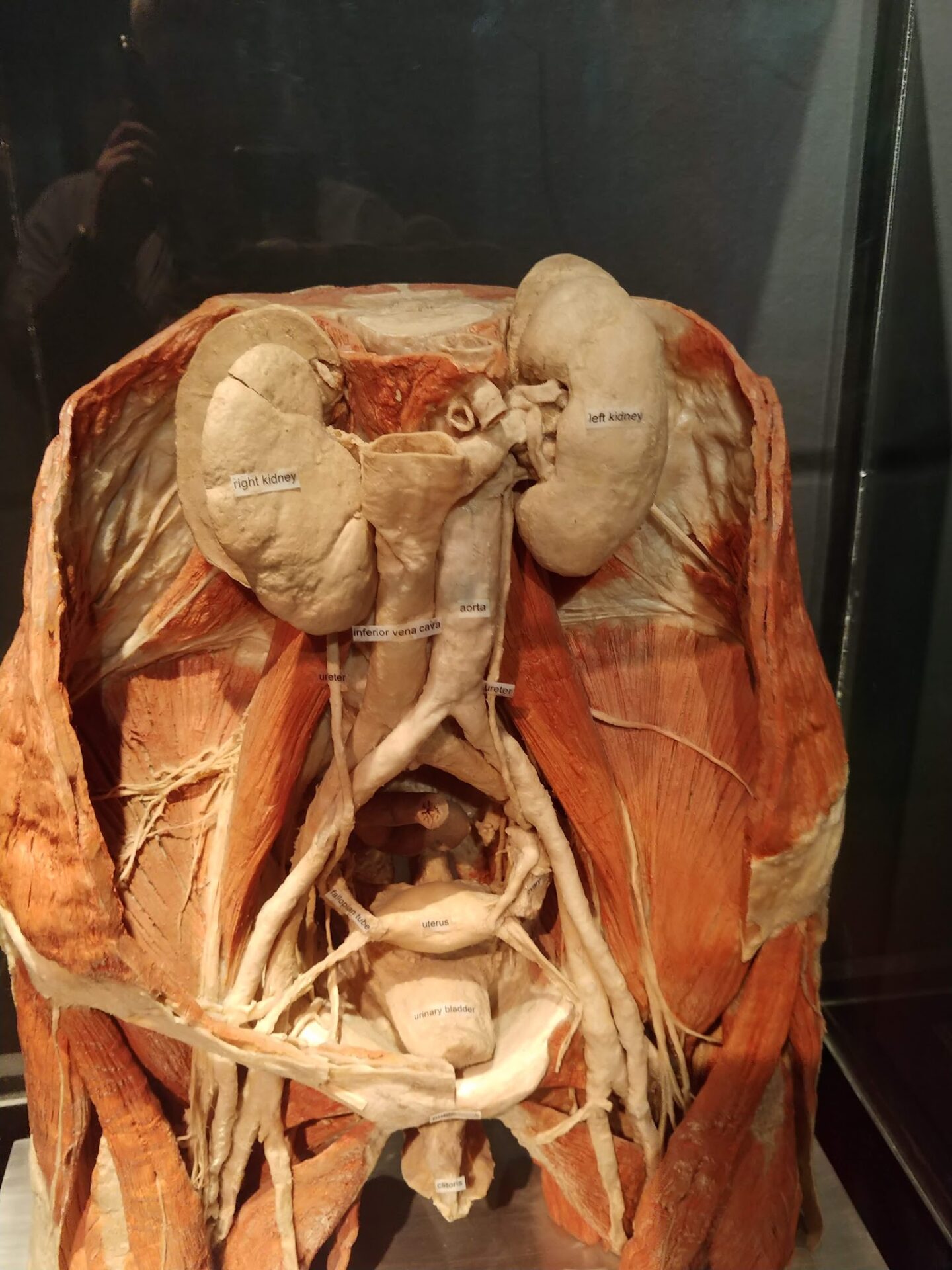 BODY WORLDS Amsterdam